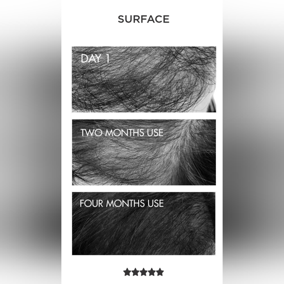 Surface Hair Awaken Box Set(unisex hair loss)Salon Professional product FIRM $ - Picture 5 of 7